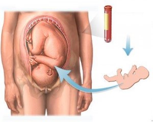 glicemia in gravidanza e diabete gestazionale
